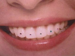 dental fashion jewellery