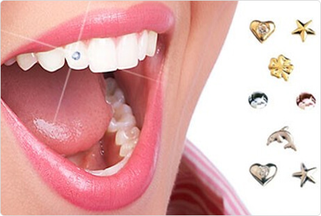 dental fashion jewellery