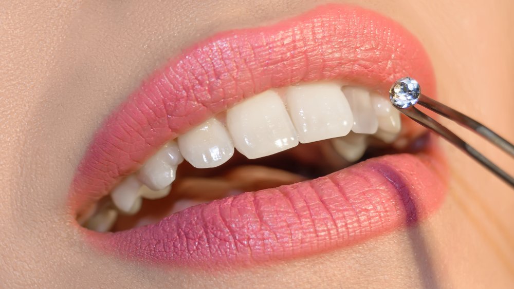 dental fashion jewellery