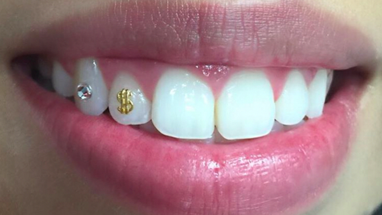 dental fashion jewellery